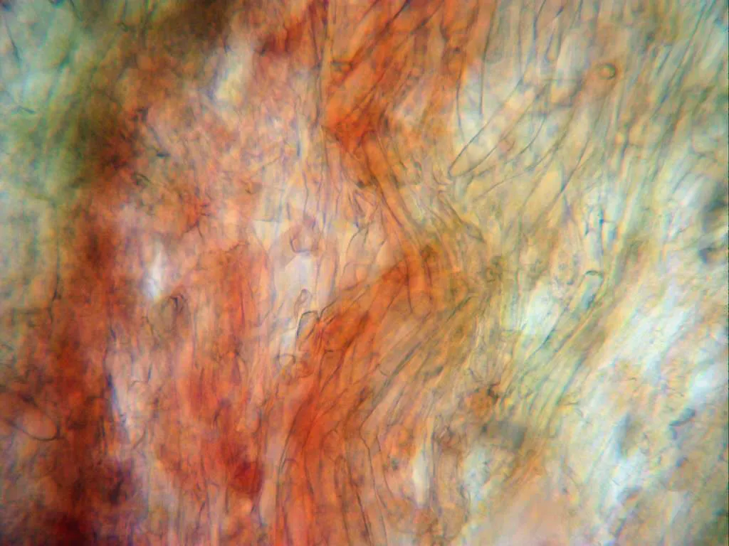 Microscopía de Psilocybe liniformans - 3 -  Cutícula x 400